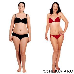 Лечние целлюлита Душем Алексеева3